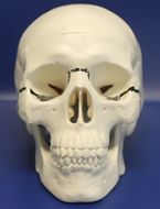 LeFort 3 figure 1