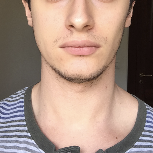Front Face 1