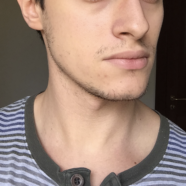 Front face 3