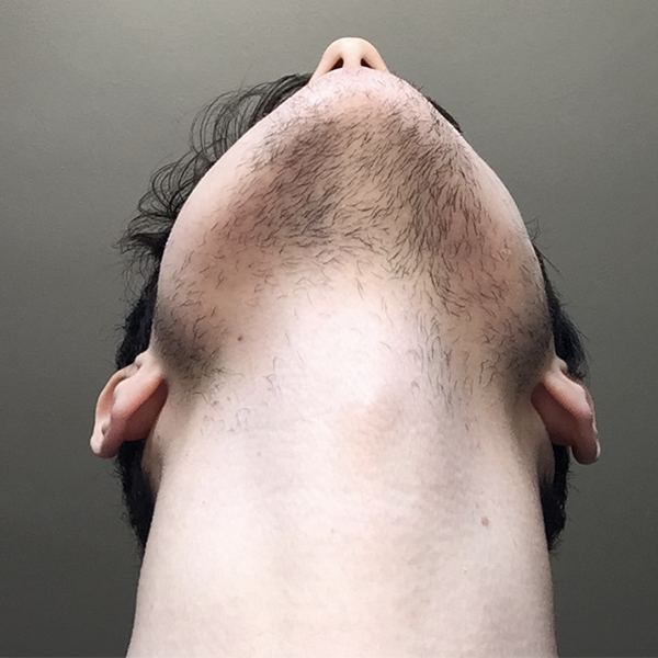 Front face 4