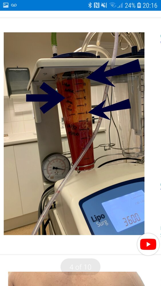 Screenshot 20201017 201635 OneDrive