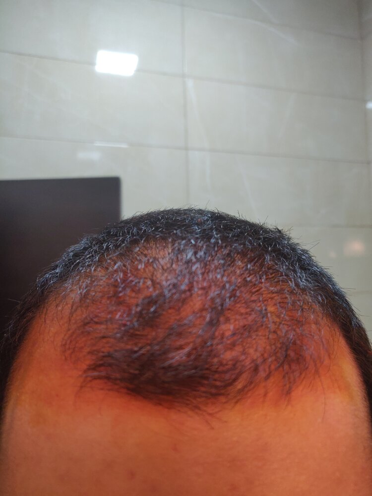 IMG 20201019 040110