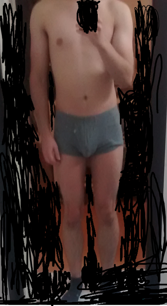 Gy