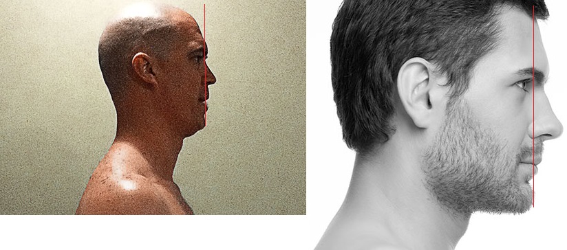 JawLineComparison