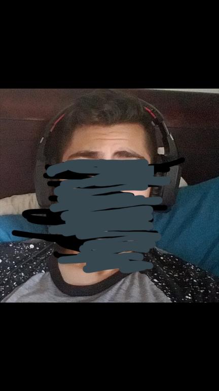 Hairline