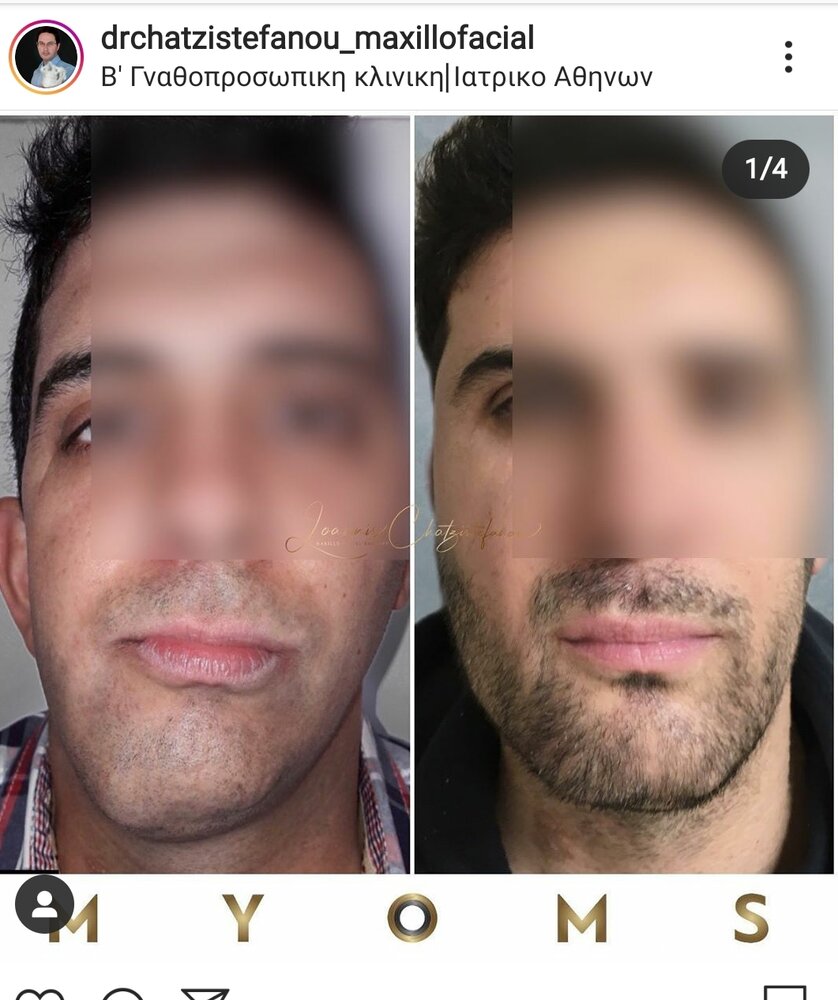 Screenshot 20201023 171559 Instagram