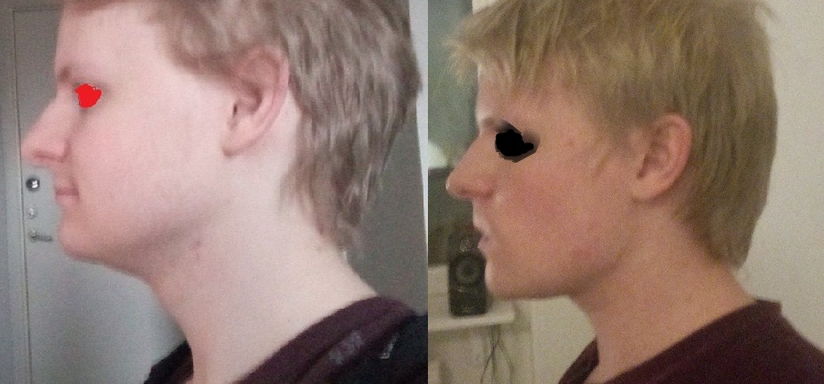BeforeAndAfter6