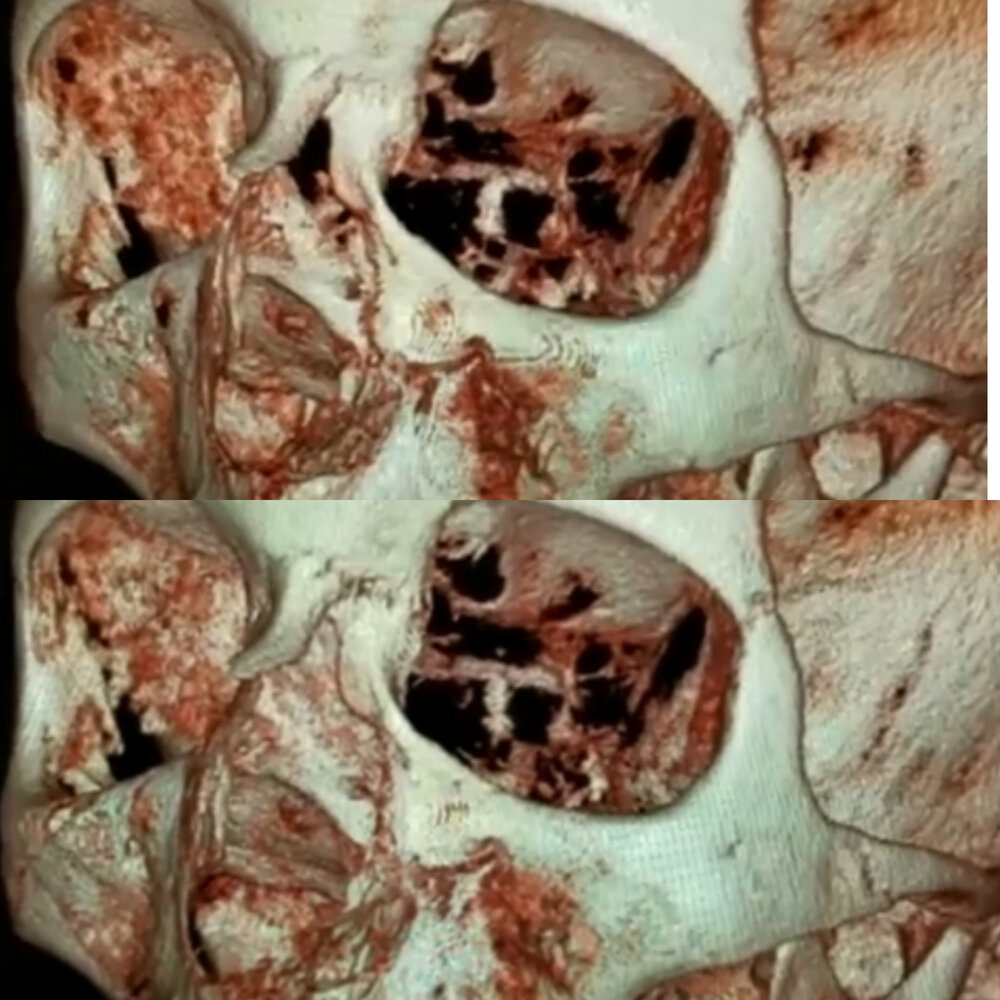 InCollage 20201024 203917593