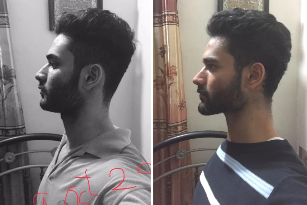 F63609719138d87e43c8d7c7b76d02e5