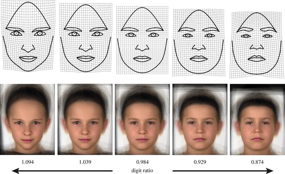 Prenatal Testosterone