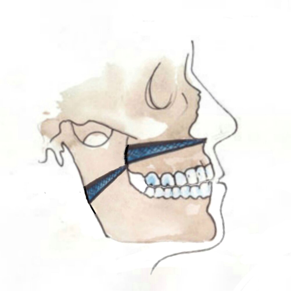 PicsArt 10 23 070115 01