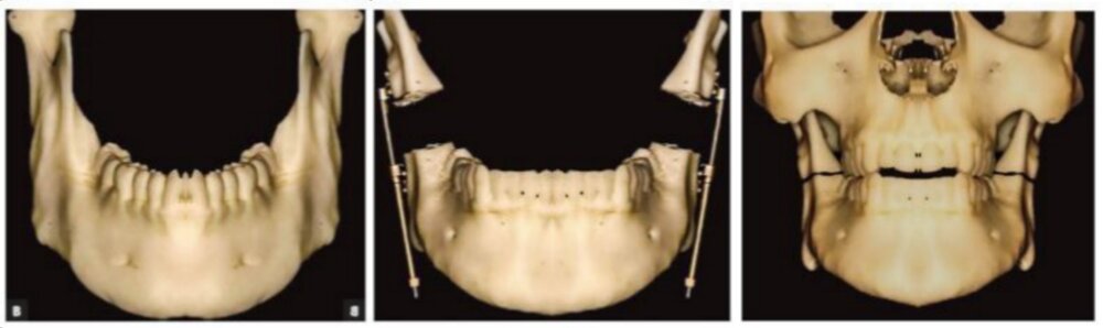 PicsArt 10 25 053730