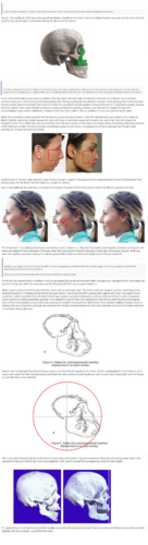 8a55e74