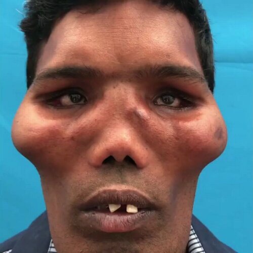 1 PAY PNLIONFACE01