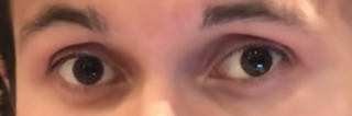 Eye
