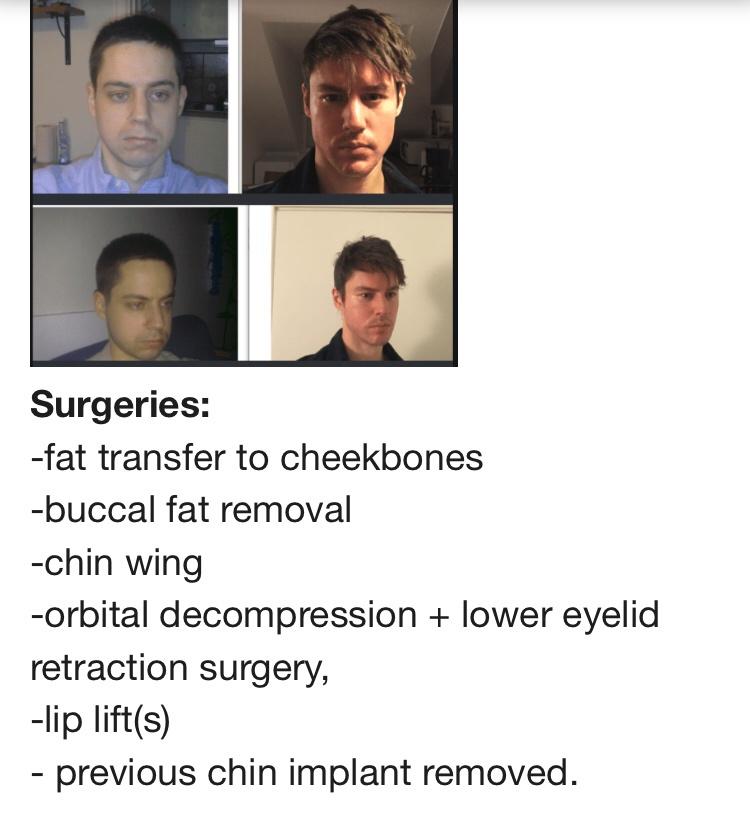 471EA2A5 B0B9 4164 9B29 6085D8DCCD10