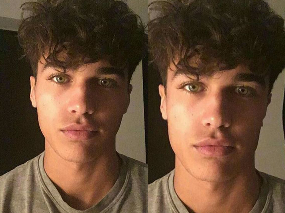 Me bone structure tbh