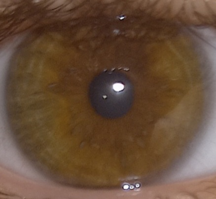 Eye