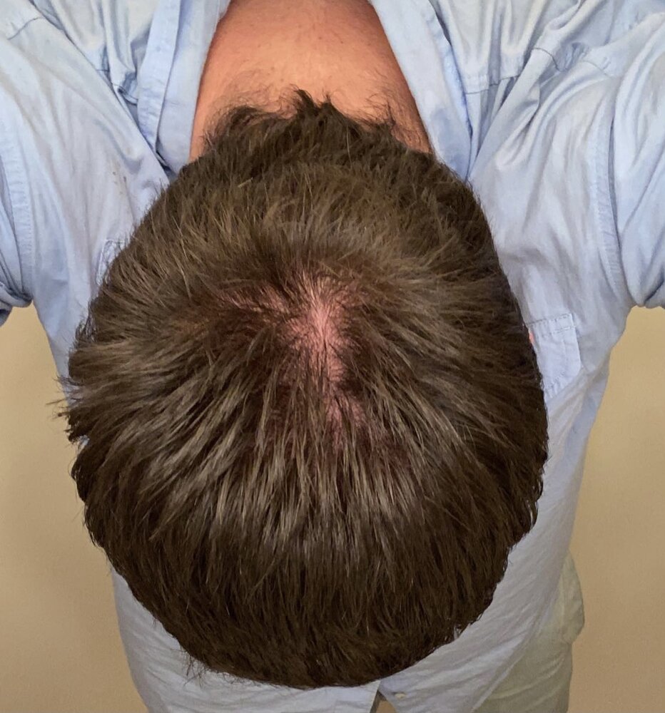 4425FD52 3BA6 44D8 929B D9A19BB34AB2