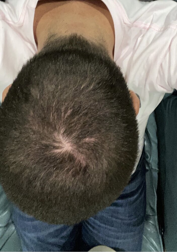 CE8DDE51 261B 437A B8AB 0B31F2C5A8A0