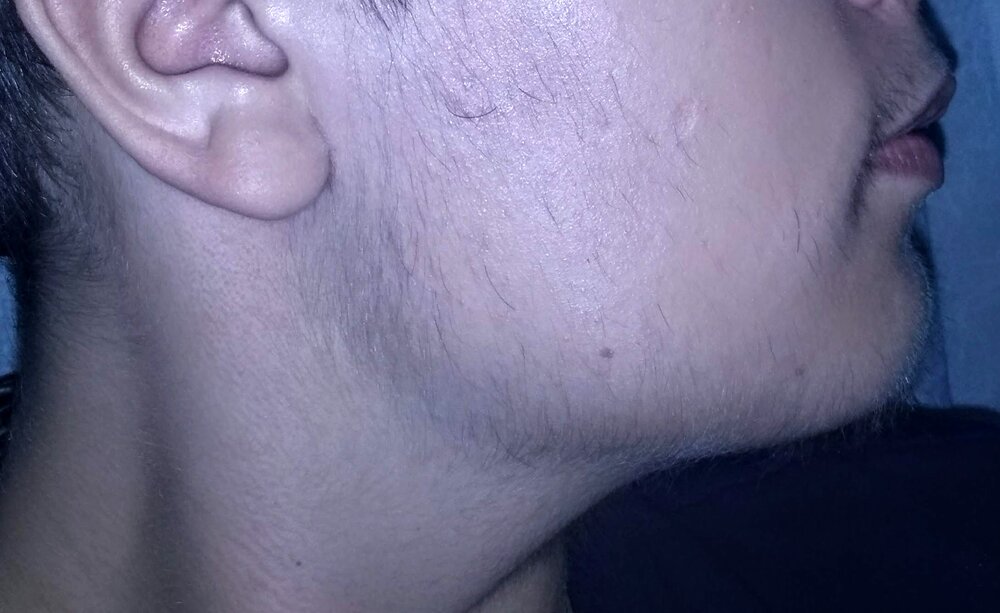 IMG 20201105 194126220