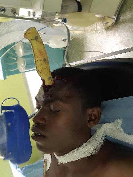 Stabbed head angola
