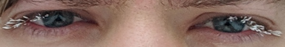 Z2
