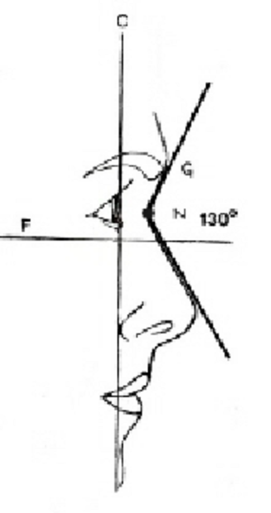 Nasofrontal angle and nasion position N nasion C corneal plane F Frankfort line G