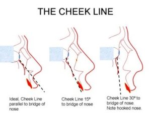 The Cheek Line 300x225