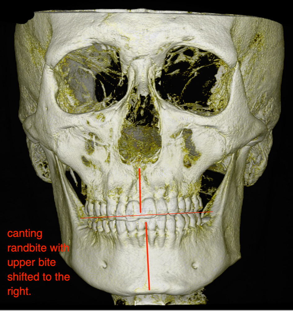 20201110 234148
