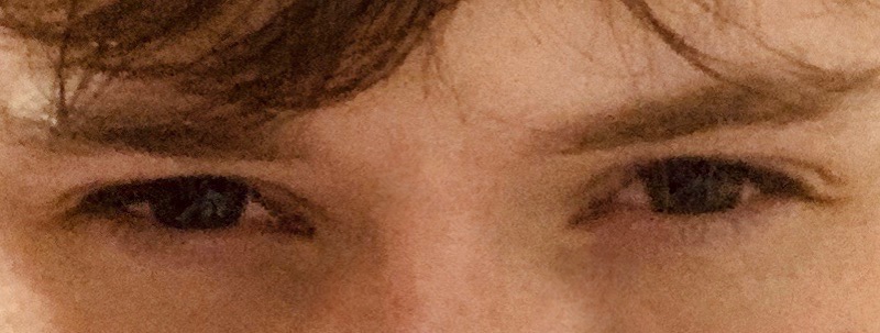Eyes
