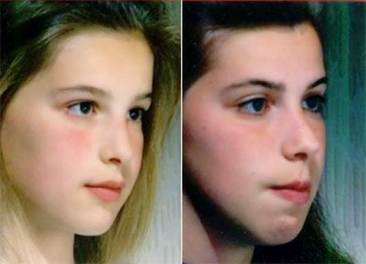 Butekyo breathing can help development in faces