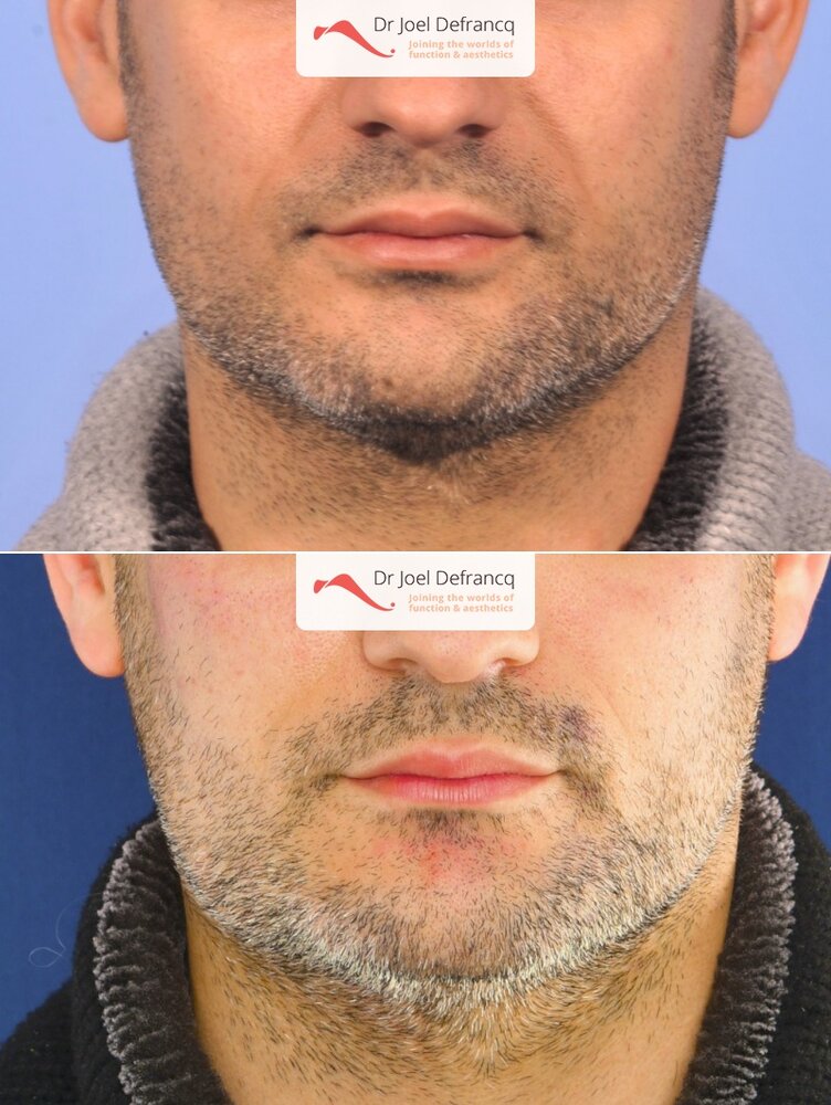Dr Joel Defrancq 1533567548024805700 7761