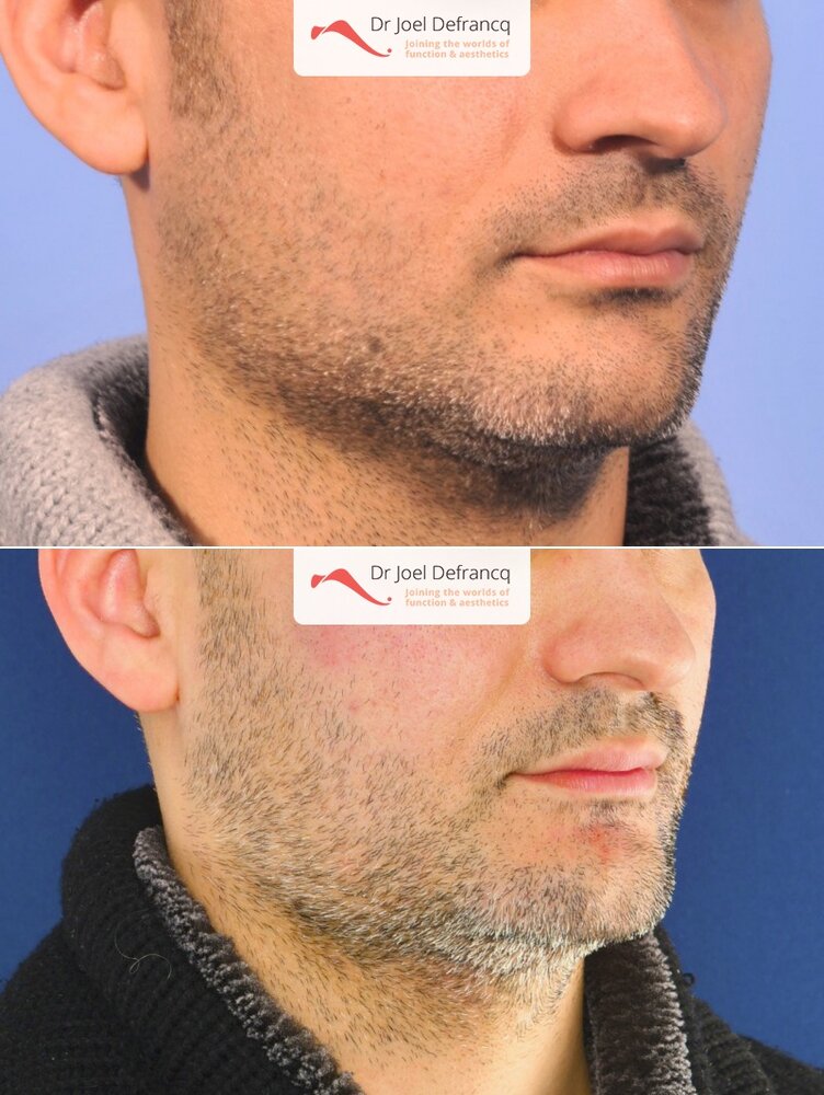 Dr Joel Defrancq 1533567595098171700 3119