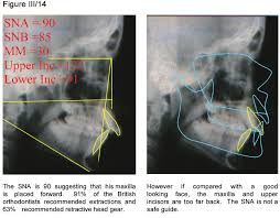 Images 2