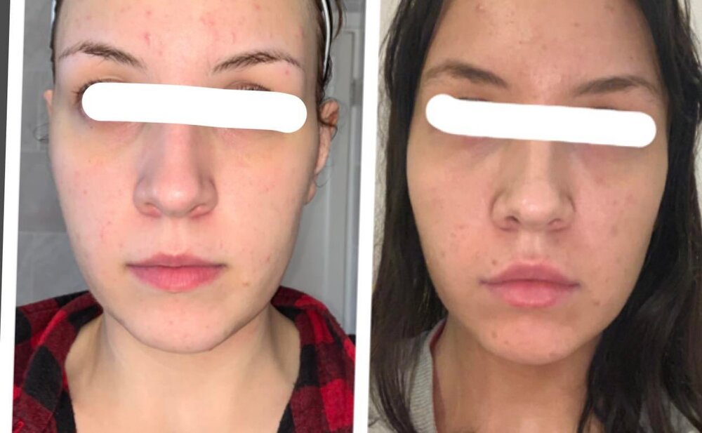 3C7BD776 7A79 42D0 9C6C 8DDCDBCC84DC