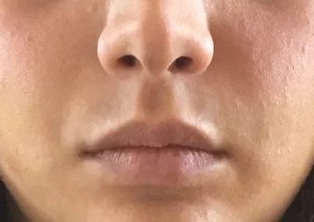 1605472242779