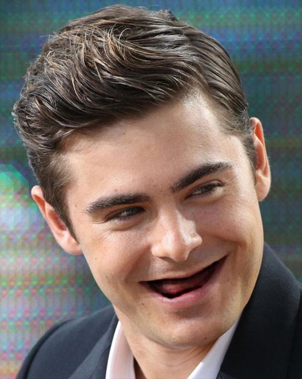 Celebrities without teeth 18