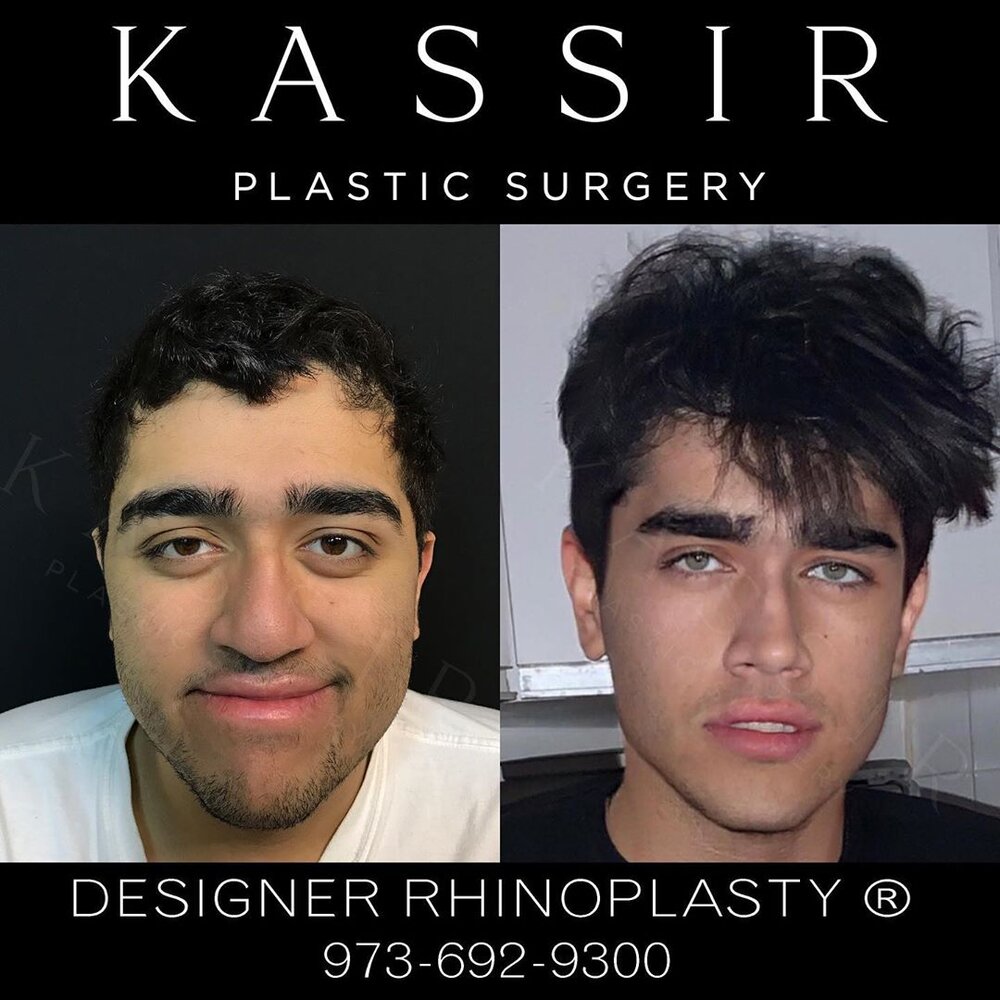 Drkassir 94399885 223460175422449 1680880828141722456 n