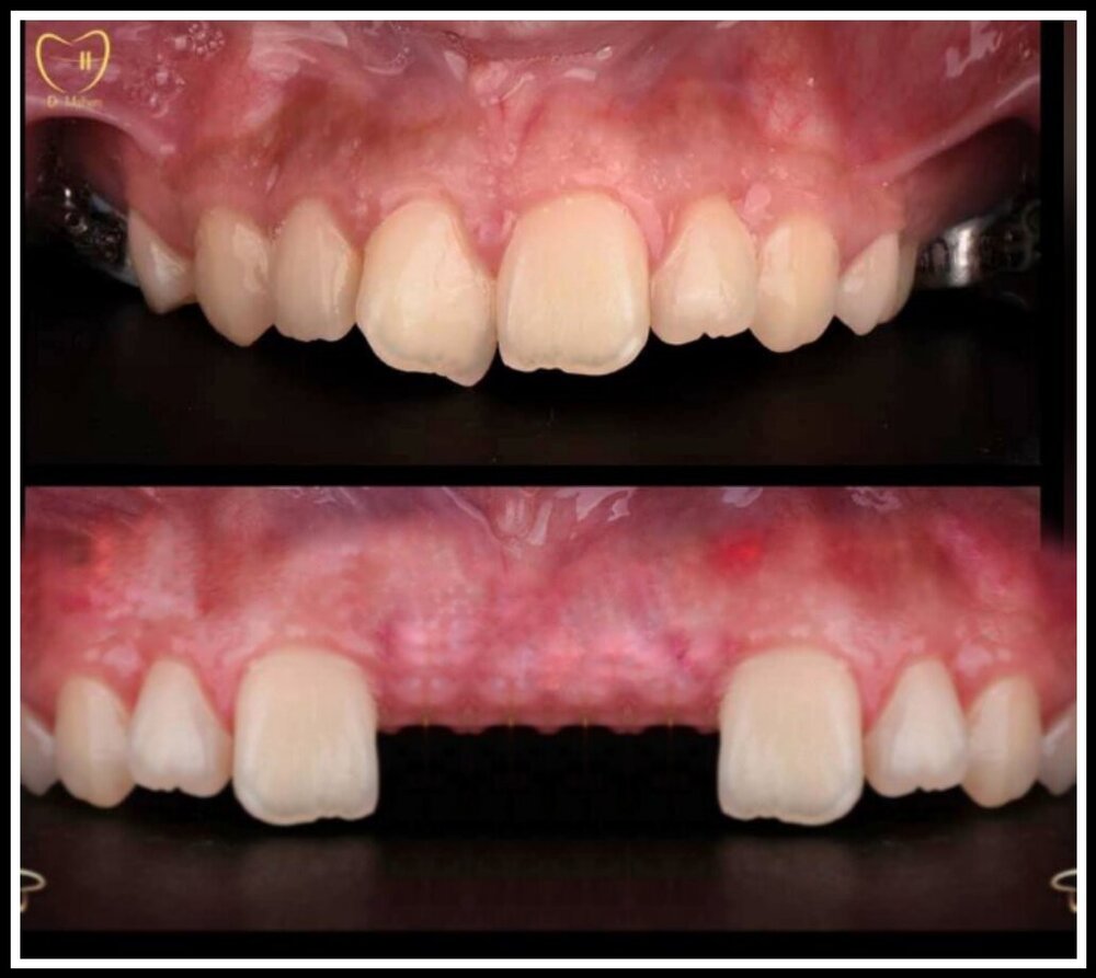 PicsArt 11 17 071116