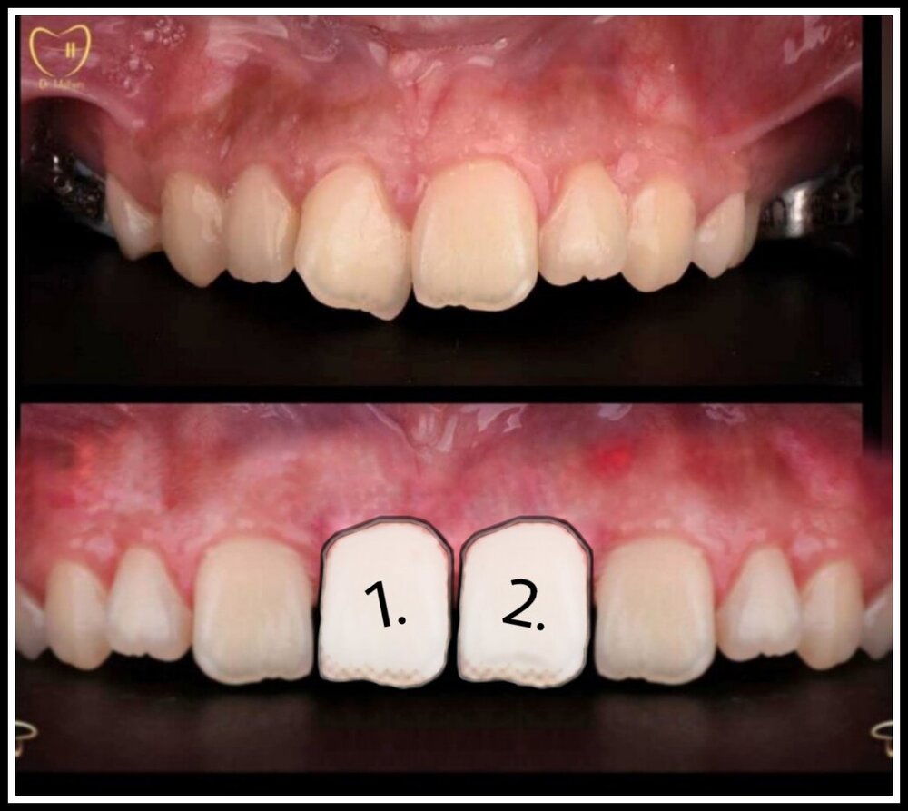 PicsArt 11 17 071140