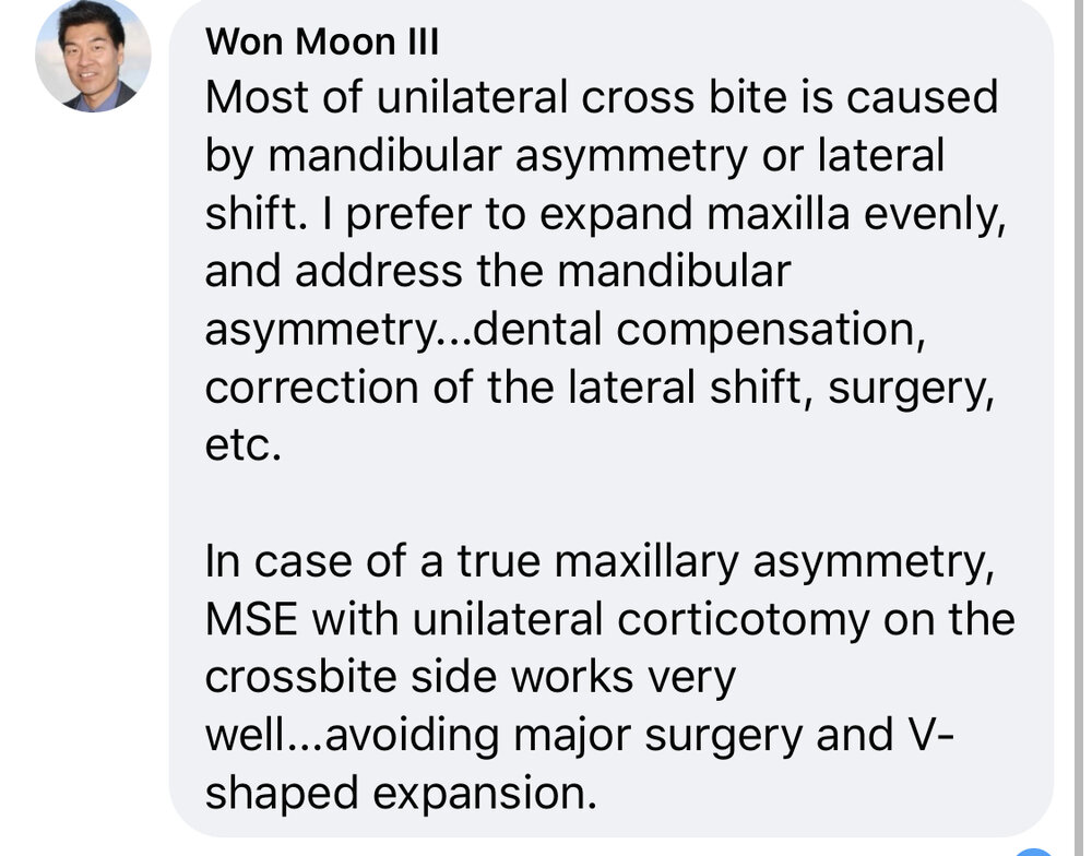 4A8306D6 1D3D 4CA0 A8CF 8A7A46A5D3DE