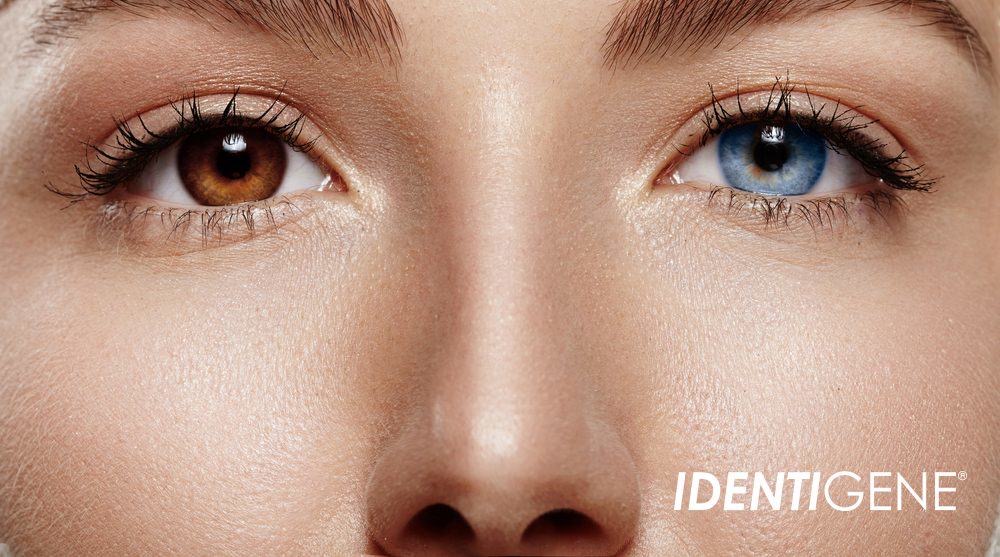 CEDEE121 CD20 474F A696 E718D44D523C