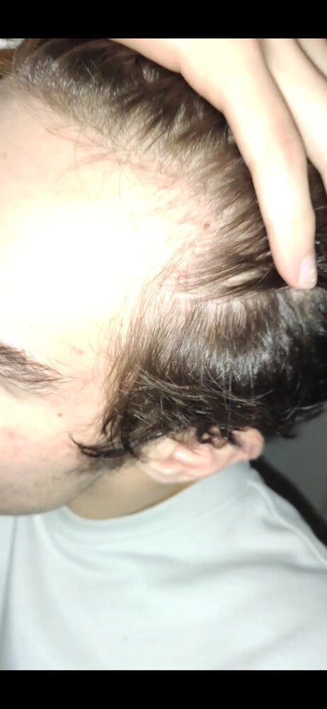 Screenshot 2020 11 18 17 30 37 330 commiuigallery