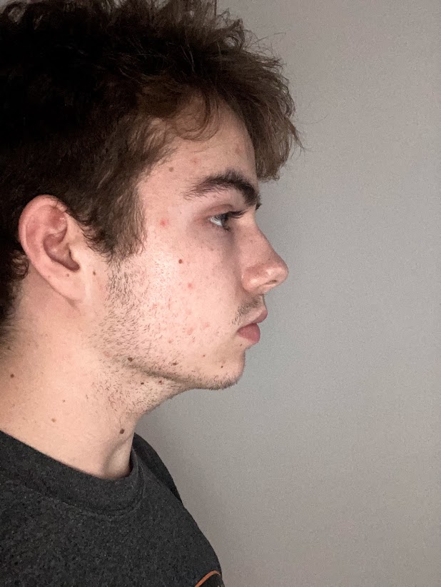 IMG 0613