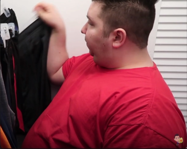 Obesity