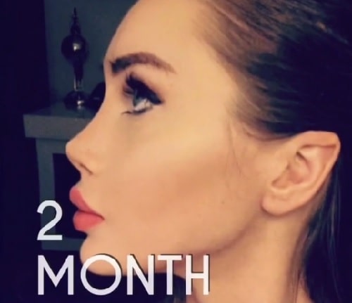 Pixee Foxs semi fantasy nose