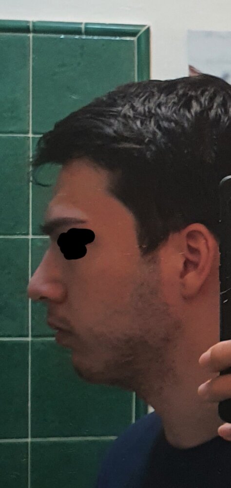 20201124 125043
