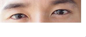 EyeareaX