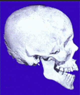 Antegonial